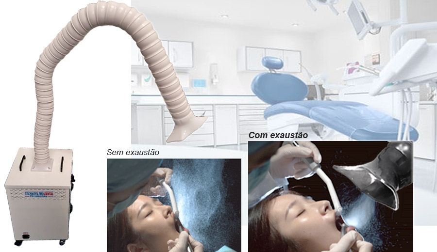 Technofiltro Dental